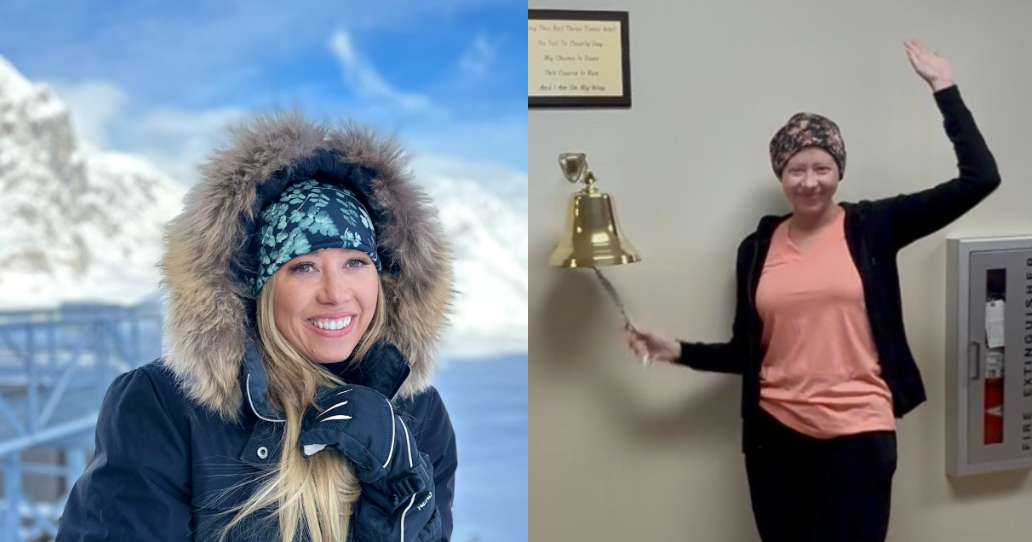 Alaska model says underarm lump led to aggressive breast cancer diagnosis
