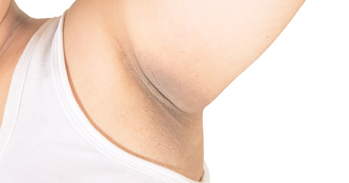 Deodorant concealer risks: Derms say tinted sticks are not daily makeup